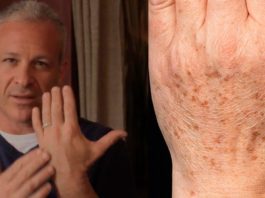 Американский доктор рекомендует: простой трюк быстро устранит пигментные пятна на коже!