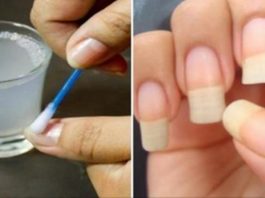 Как отрастить ногти, которые никогда не сломаются: поможет простое средство из 4 компонентов